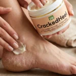 Close up of a herbal cracked heels remedy being massaged into a heel.